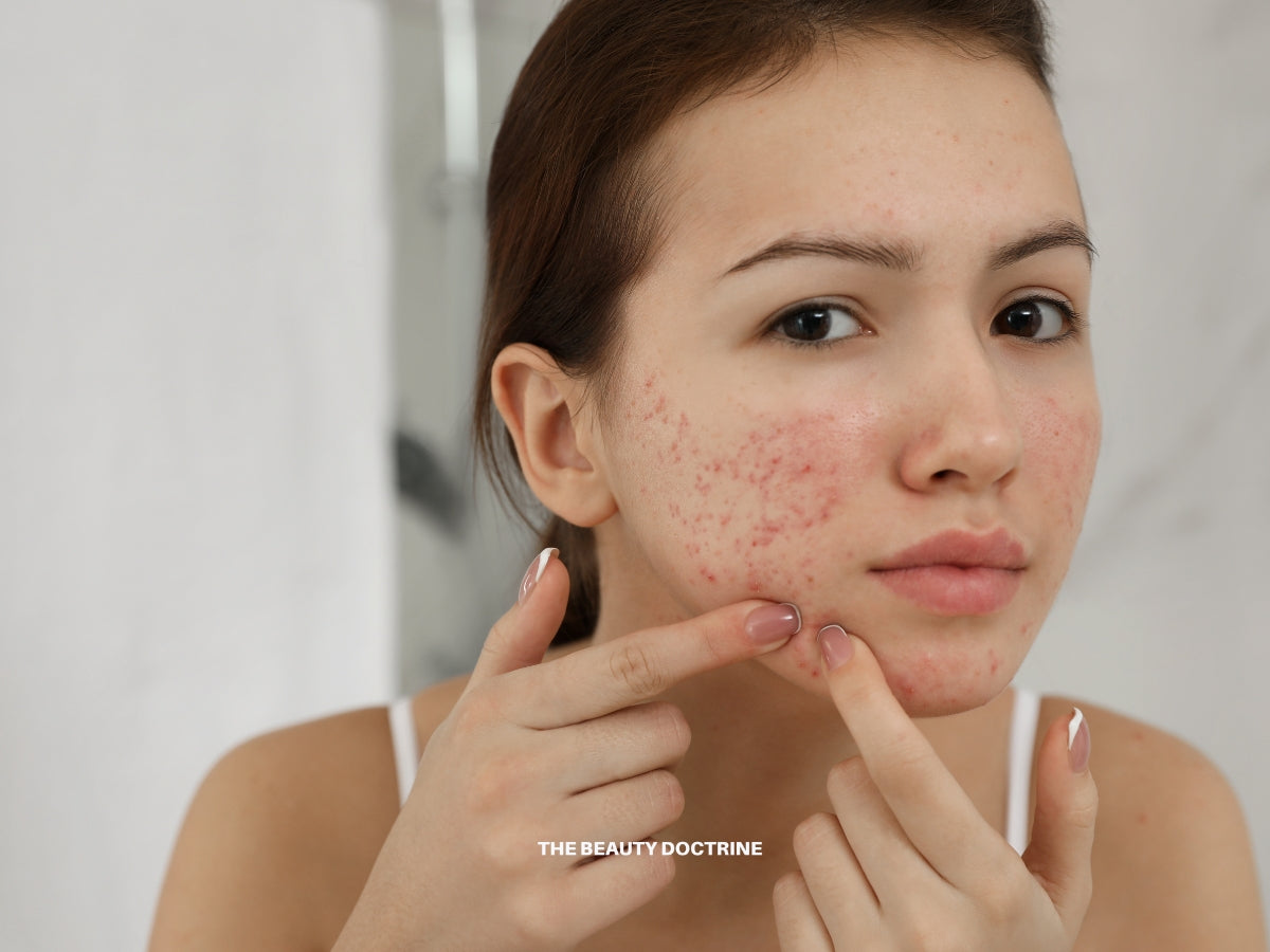 Woman with clear skin representing the functional beauty approach to clearing acne at the root