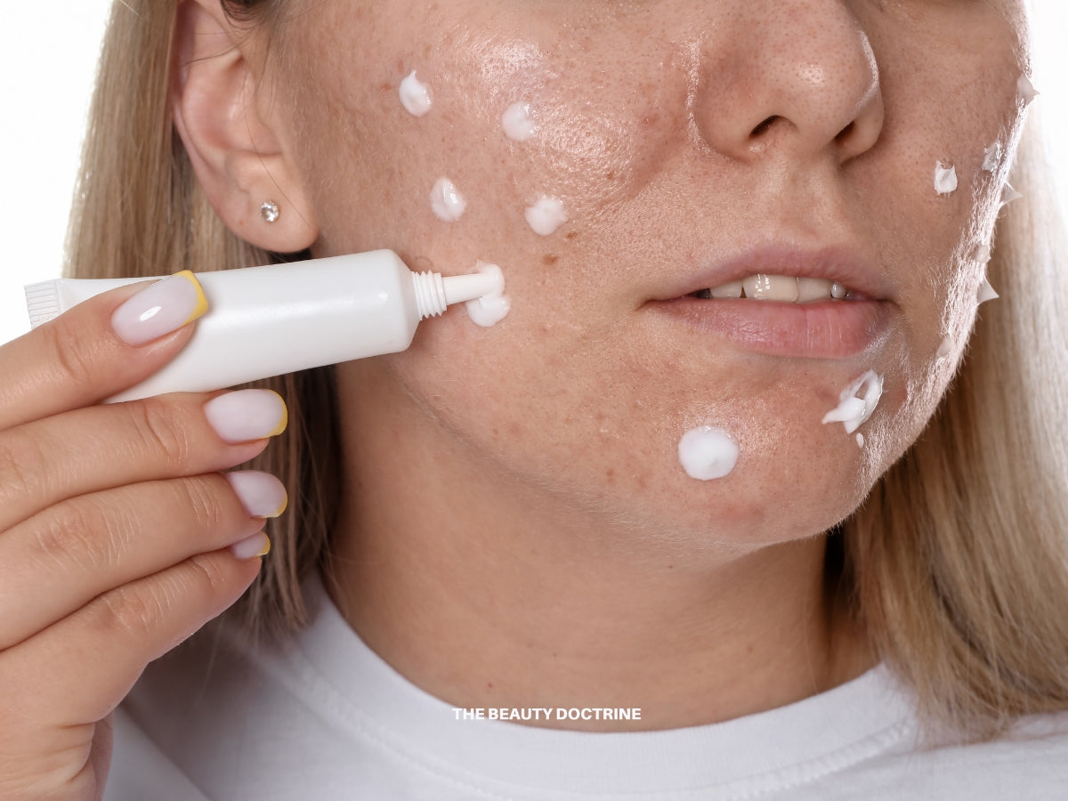 Acne is an inflammatory condition — understanding the root cause for clear skin