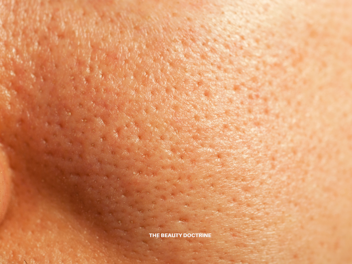 Best Skincare for Large Pores