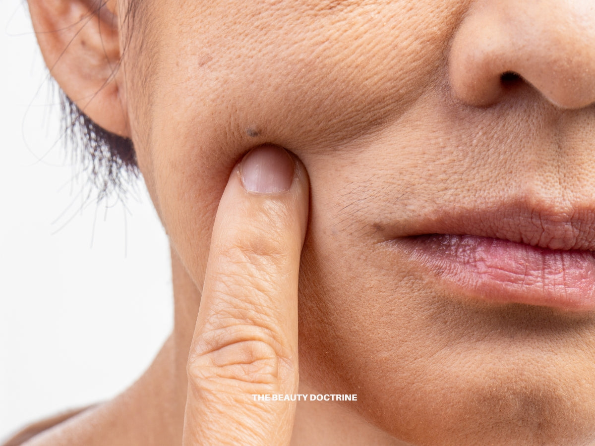 Illustration of facial lymphatic drainage and fascia pathways related to aging and puffiness